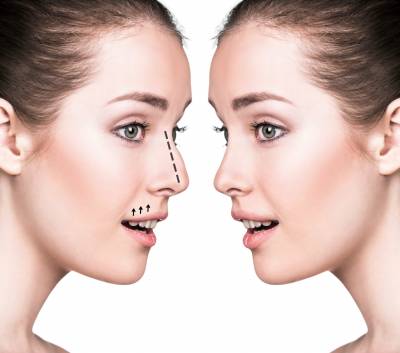 Nose Surgery Procedure
